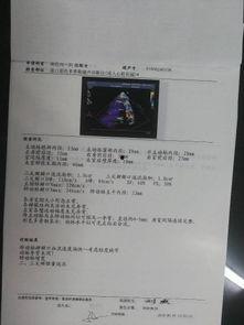 心脏彩超教学视频